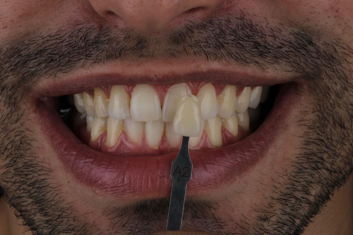 WhatsApp Image 2025-06-13 at 16.32.01 (1) WhatsApp Image 2025-06-13 at 16.32.01 (1)