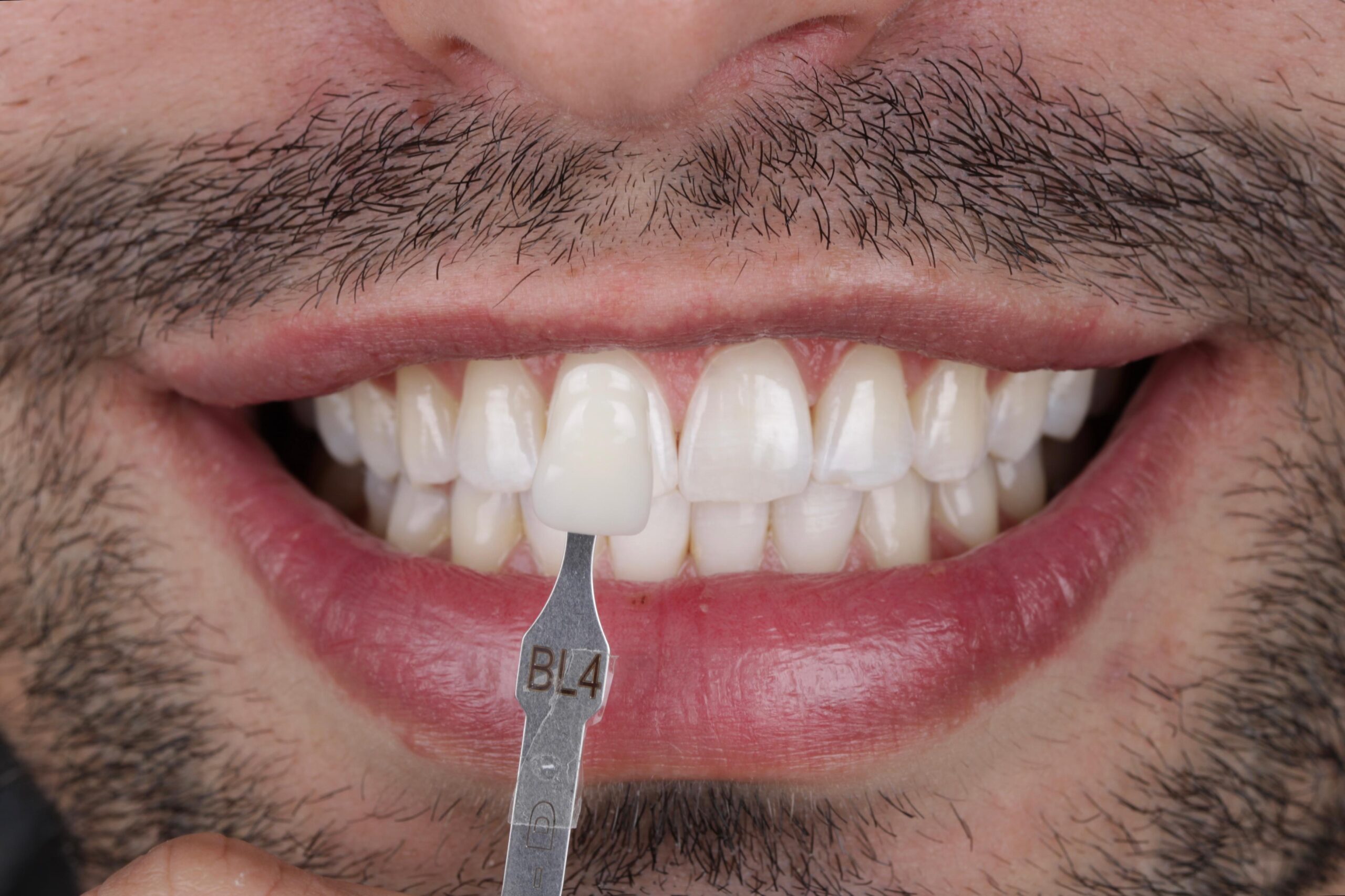 WhatsApp Image 2025-06-13 at 16.32.01