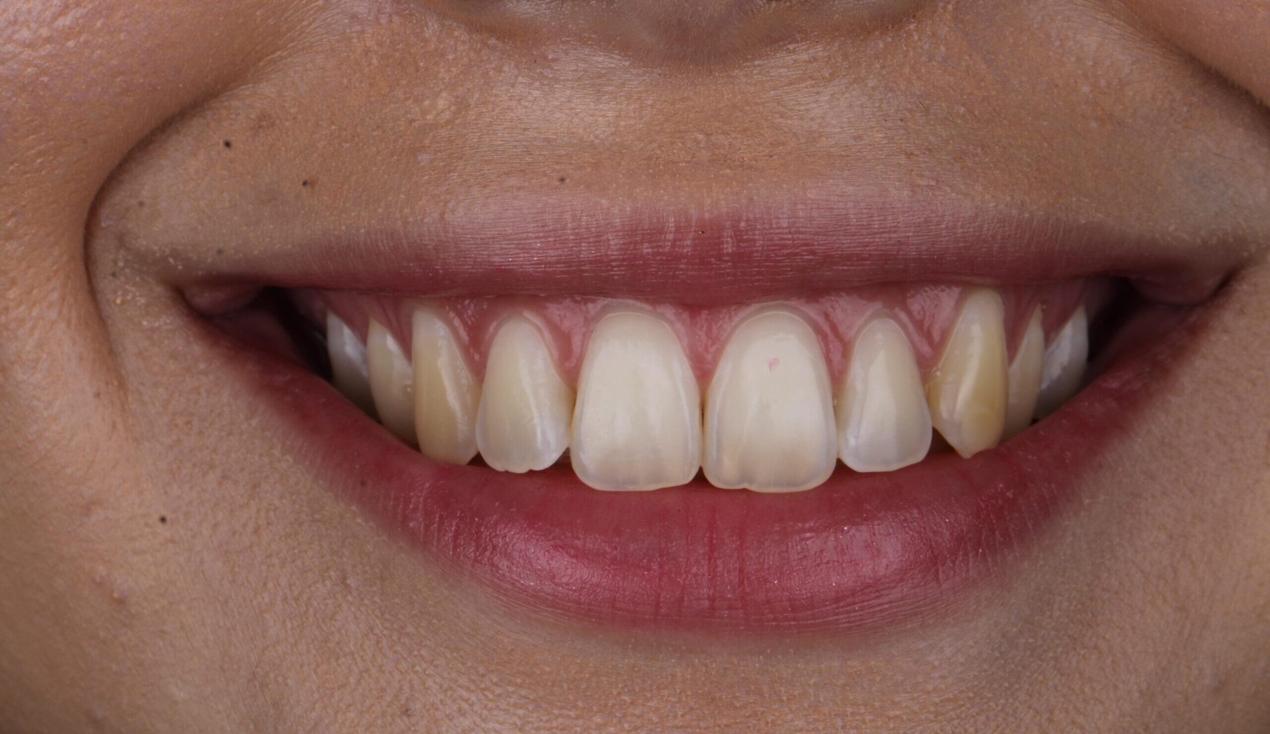 WhatsApp Image 2025-06-13 at 16.56.04 (1) WhatsApp Image 2025-06-13 at 16.56.04 (1)